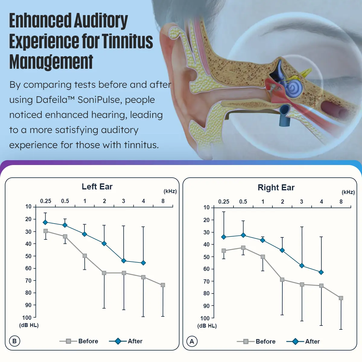 Dafeila™ SoniPulse Tinnitus Relief Soothing Aid - Image 5