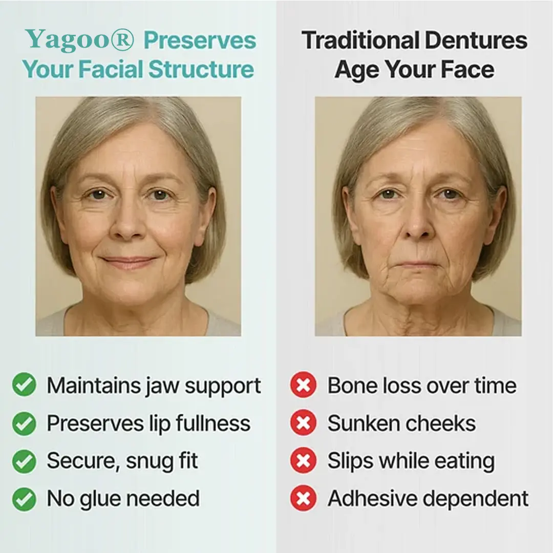 Custom-Fit Full Functional Dentures - Image 4