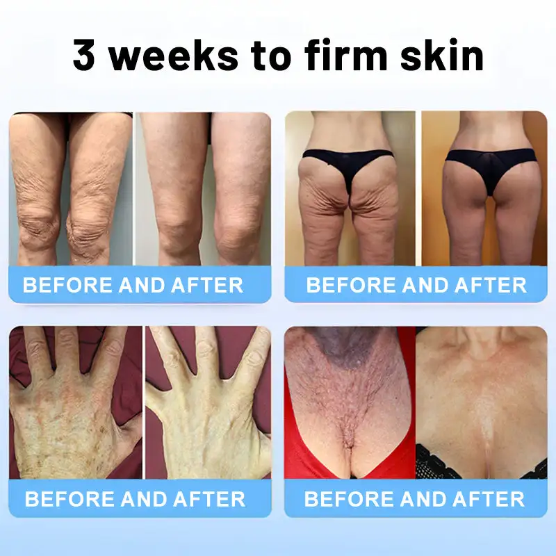 Oligopeptide-Infused Skin Firming Cream - Image 5