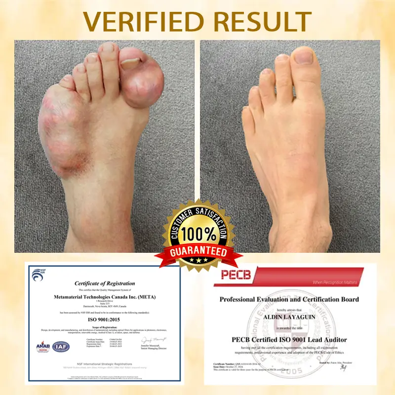 BeeEase MicroSting Joint Patches - Image 5