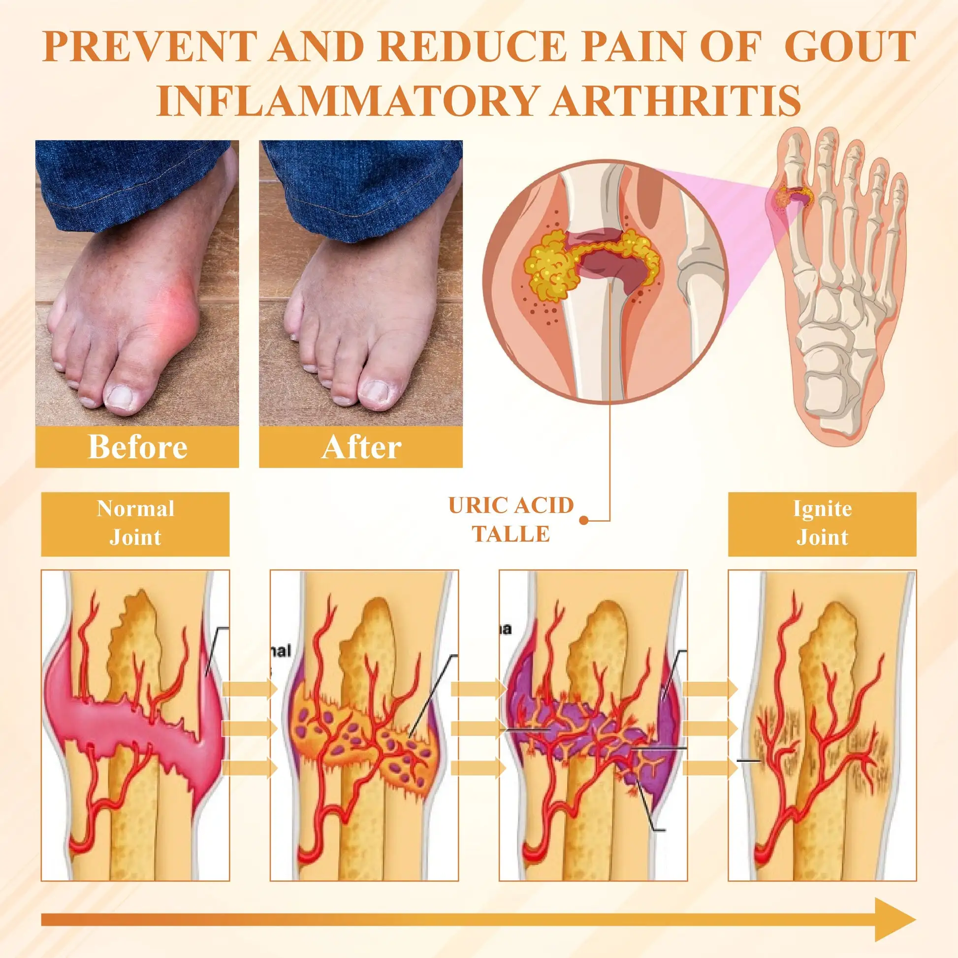 BeeEase MicroSting Joint Patches - Image 9
