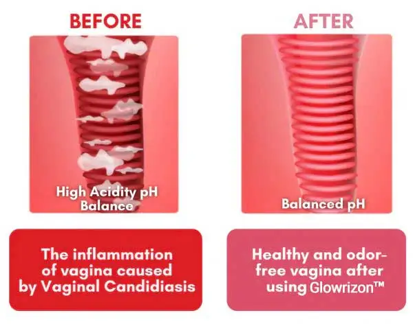 Feminine Intimate Care Cleansing Soap - Image 10