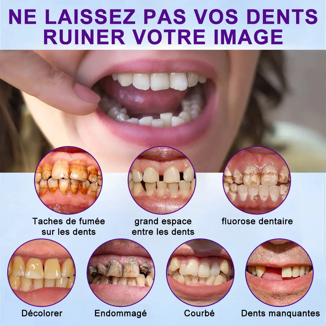 Prothèse Dentaire Complète Sur Mesure Haut de Gamme - Image 4