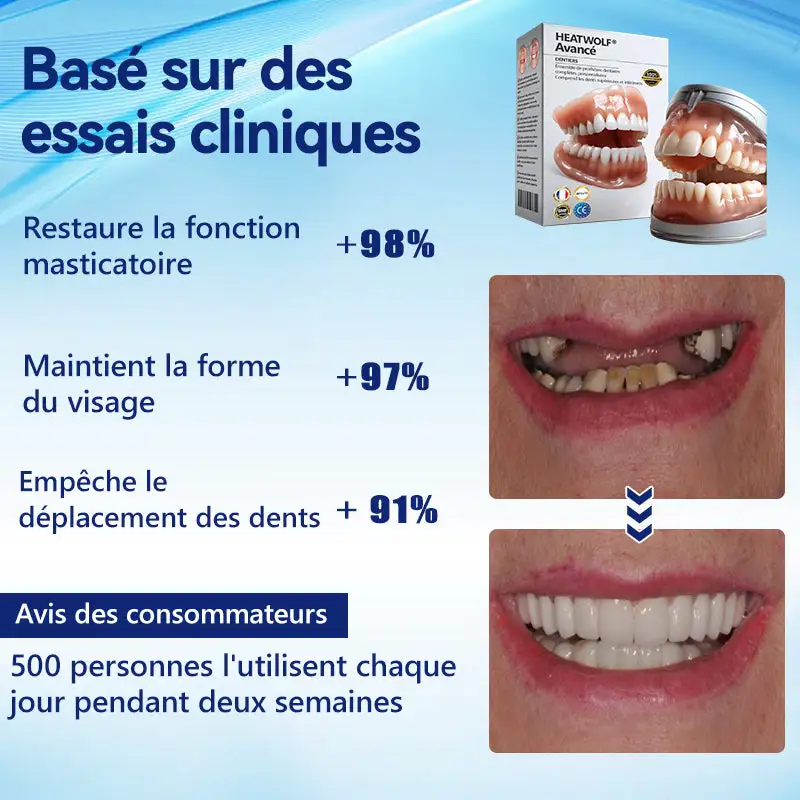 Prothèse Dentaire Complète Sur Mesure Haut de Gamme - Image 3