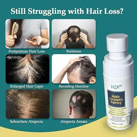 Natural Hair Growth Oil Spray - Image 3