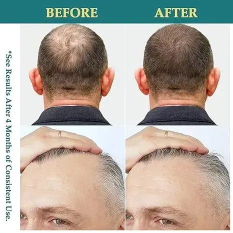 Natural Hair Growth Oil Spray - Image 6