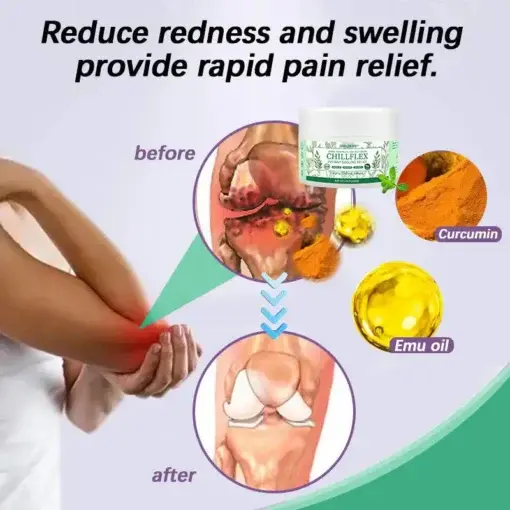 CHILLFLEX Herbal Pain Relief Cream - Image 2