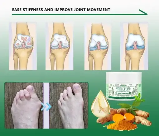 CHILLFLEX Herbal Pain Relief Cream - Image 8