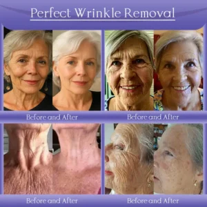 Alternative view of Anti-Wrinkle Skin Cream for Remove Wrinkles