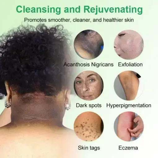 Purifying Exfoliating Gel for Acanthosis Nigricans - Image 6