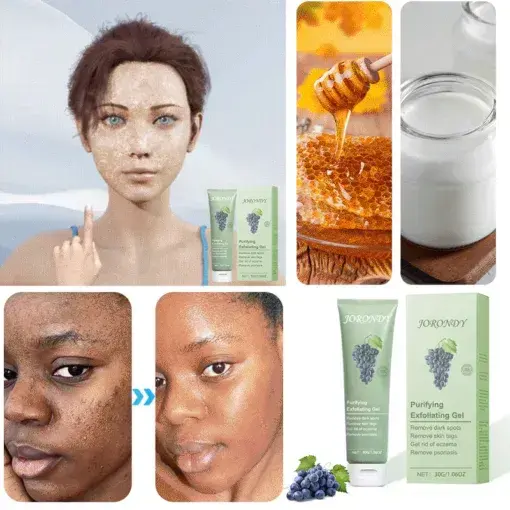 Purifying Exfoliating Gel for Acanthosis Nigricans - Image 8