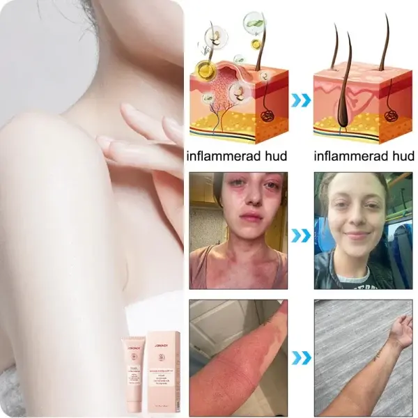 Purifying Peeling Gel - Image 13