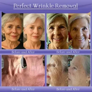 Alternative view of Skin Firming & Anti-Wrinkle Cream