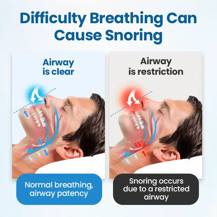 Nasal Breather - Image 3