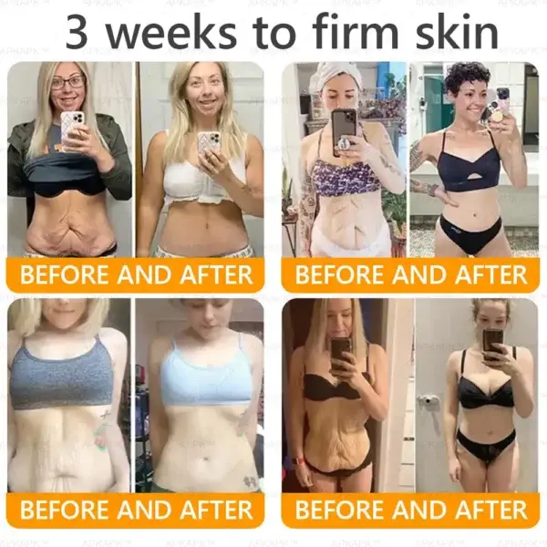 Bee venom Comprehensive Cream - Image 7