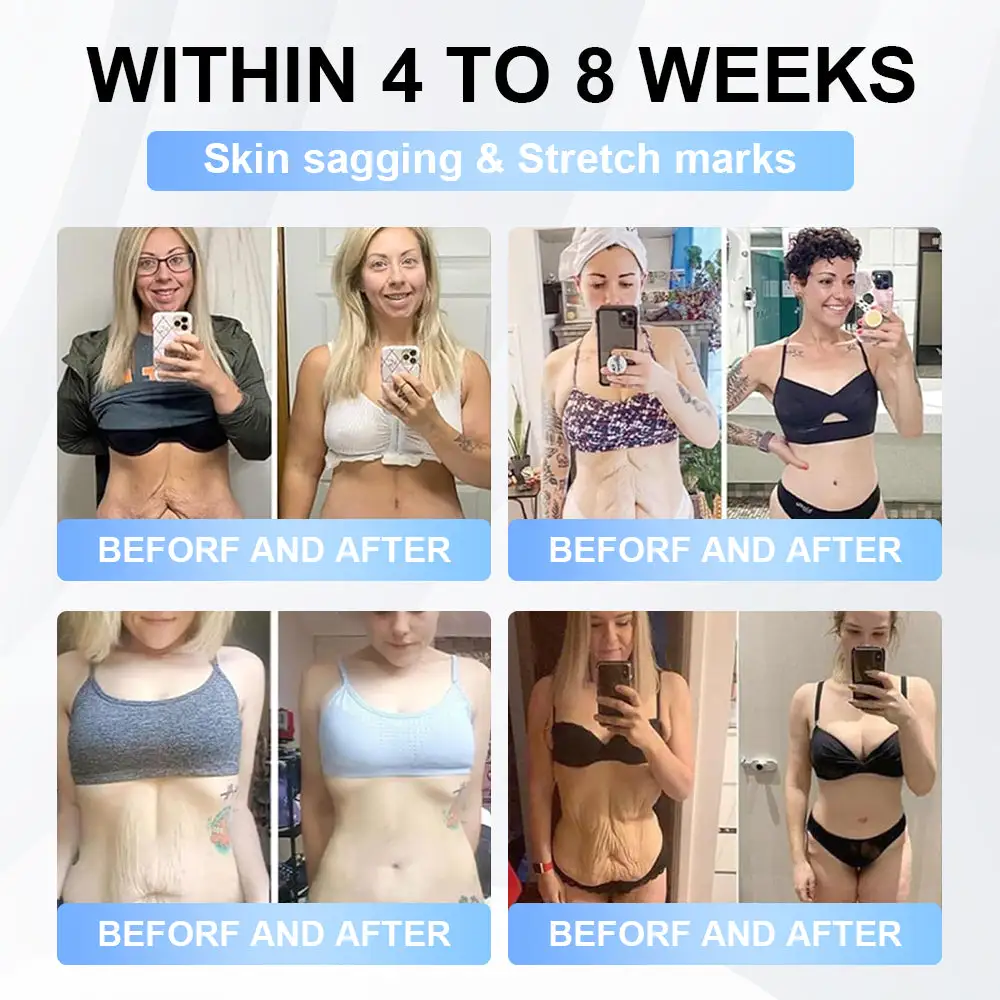 Nano Microneedle Patch - Image 3