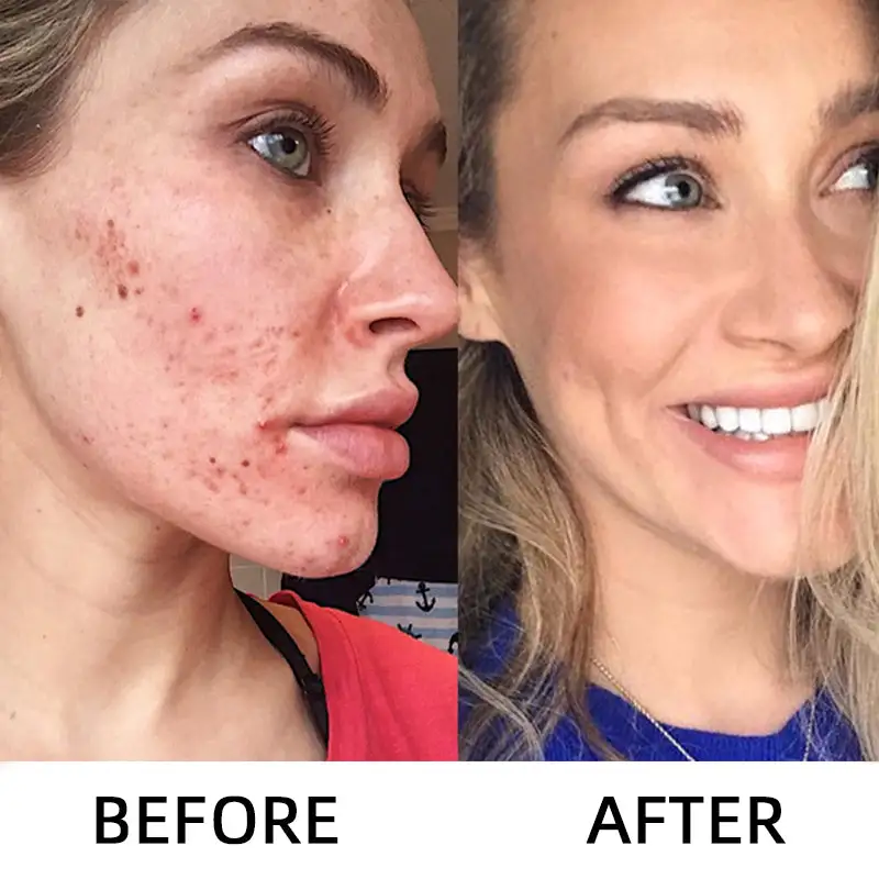 LOVILDS Glow Rice Ampoule Duo - Serums for Brightening Exfoliating and Moisturizing - Image 3