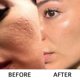 LOVILDS Glow Rice Ampoule Duo - Serums for Brightening Exfoliating and Moisturizing - Image 4