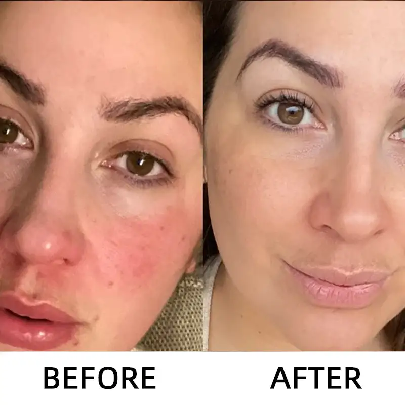 LOVILDS Glow Rice Ampoule Duo - Serums for Brightening Exfoliating and Moisturizing - Image 5