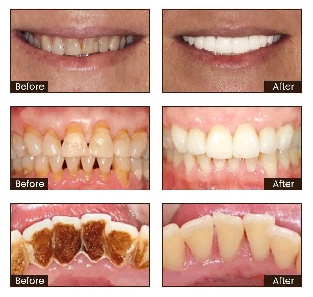 Nicotinamide Whitening Toothpaste - Image 3