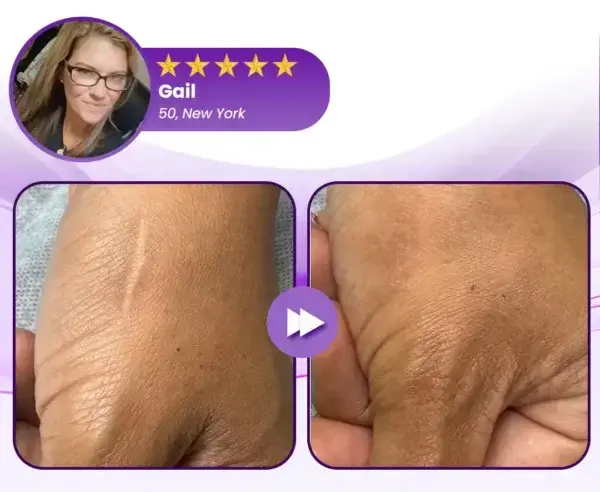 Face & Body Scar Gel - Image 10