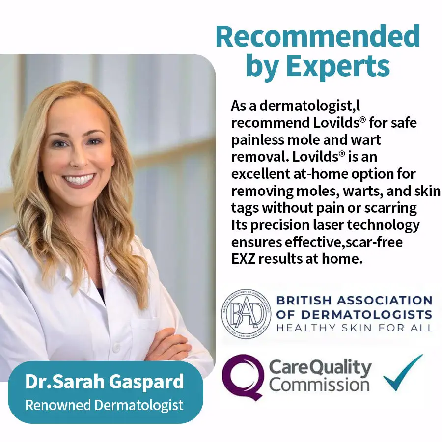 Non-Invasive Mole and Wart Removal Laser Pen - Image 4