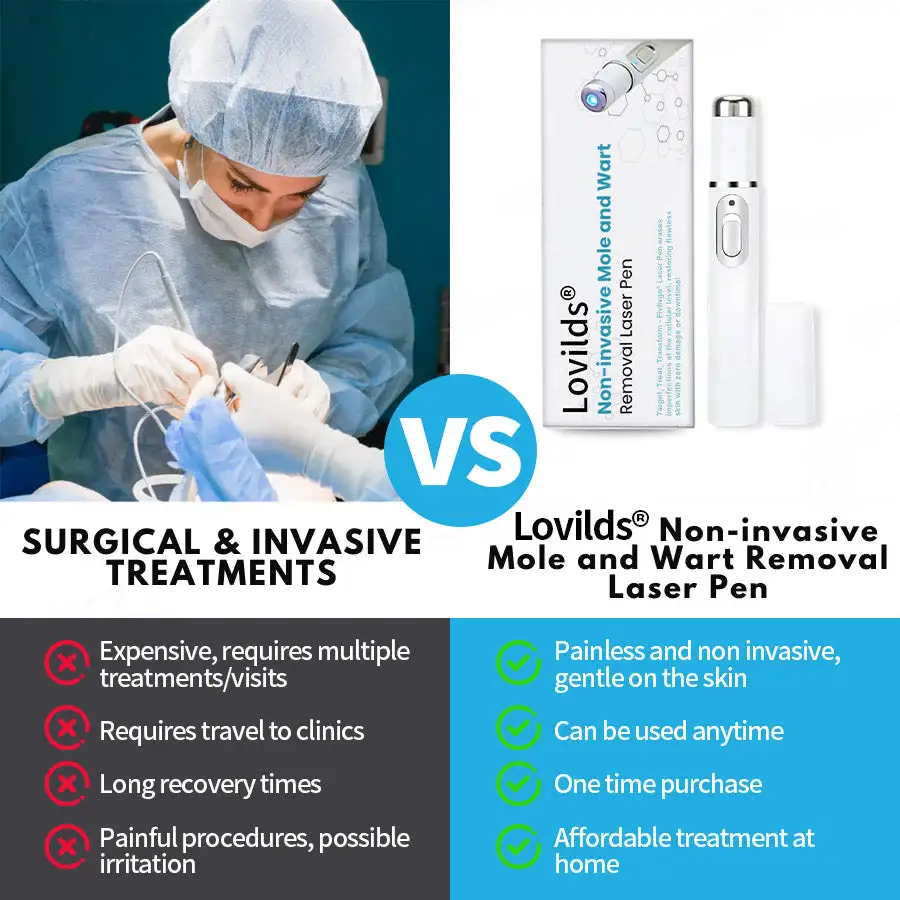 Non-Invasive Mole and Wart Removal Laser Pen - Image 7