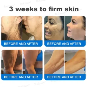 Alternative view of Advanced Firming & Wrinkle-Reducing Cream