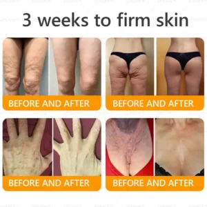 Alternative view of Bee venom Comprehensive Cream