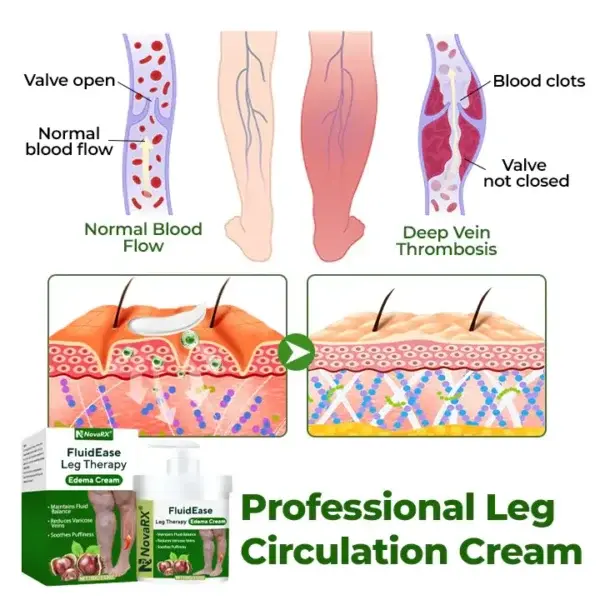Leg Therapy Edema Cream - Image 4