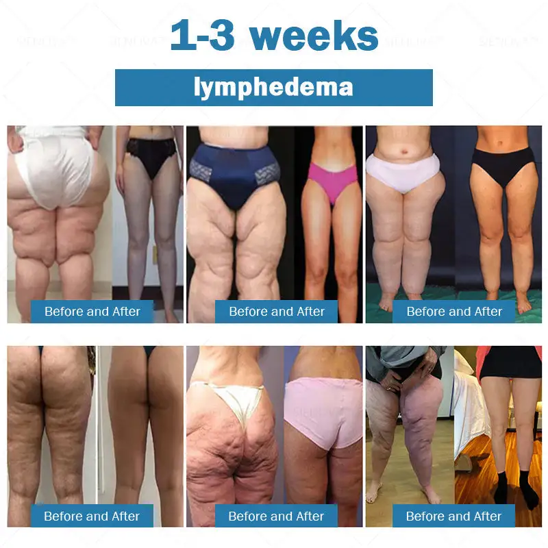 ๐ต๐๐๐ ๐ด๐๐๐๐๐๐๐๐
๐๐ ๐ท๐๐๐๐ - Image 9