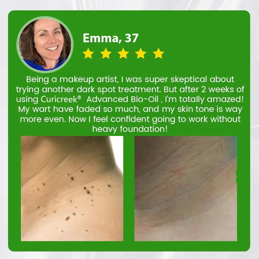 Advanced Pro Bio-Oil Mole Spot Corrector Enhanced with Alligator Oil - Image 7