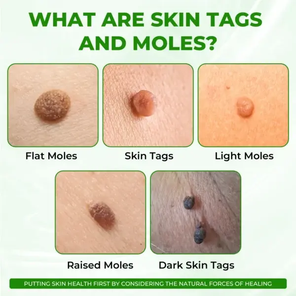 Instant Mole & Spot Cream - Image 10