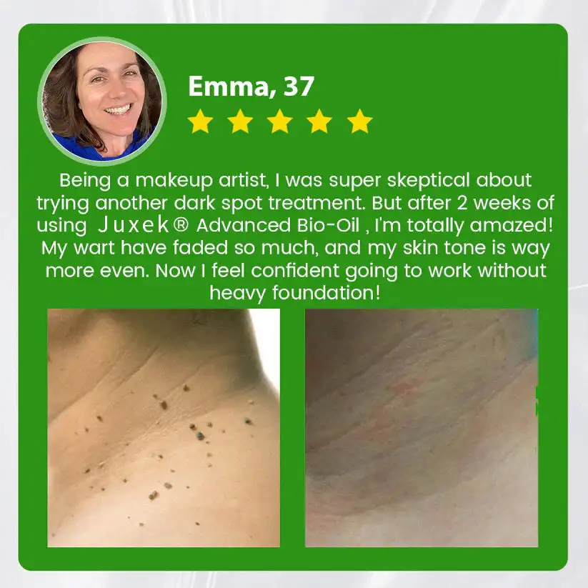 Advanced Bio-Oil Mole Spot Corrector - Image 7