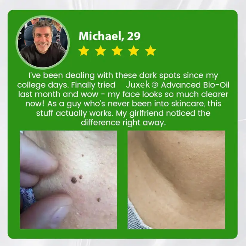 Advanced Bio-Oil Mole Spot Corrector - Image 8