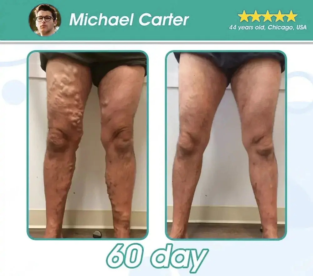 Liquid Pearl - Image 4