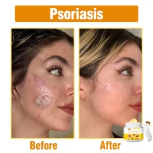 Alternative view of Bee Venom Comprehensive Cream