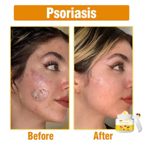 Bee Venom Comprehensive Cream - Image 2