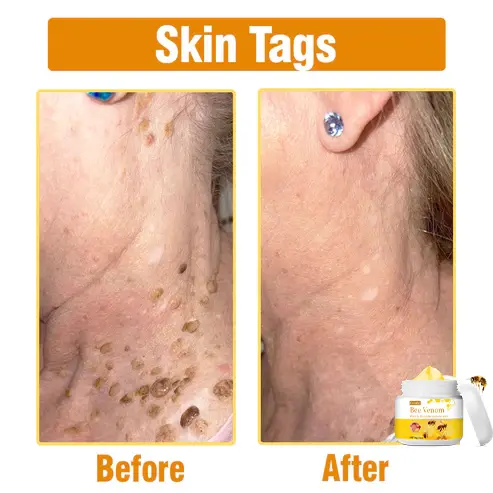 Bee Venom Comprehensive Cream - Image 4