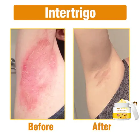 Bee Venom Comprehensive Cream - Image 7