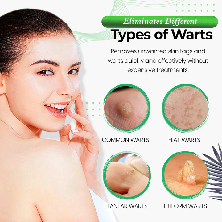 Wart Wipeout Soap - Image 4