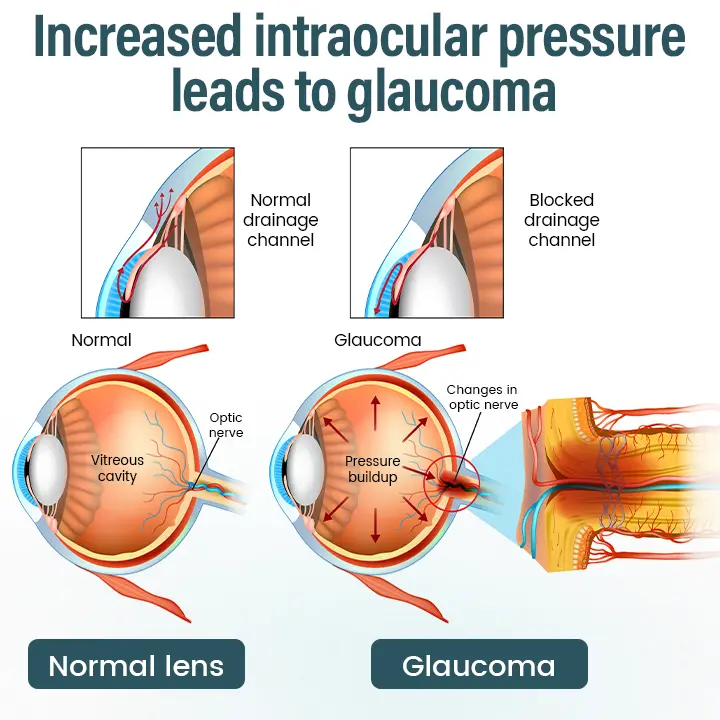 Nano Eye Drops Serum - Image 7