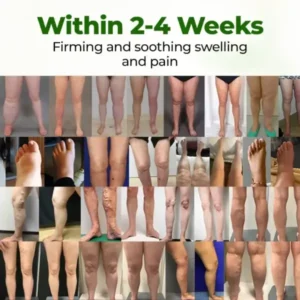 Professional Leg Circulation Cream