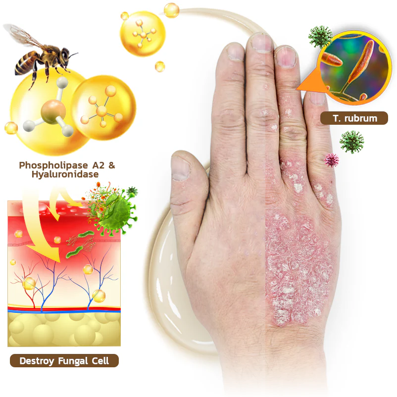 PsoriX Bee Venom Cream - Image 3