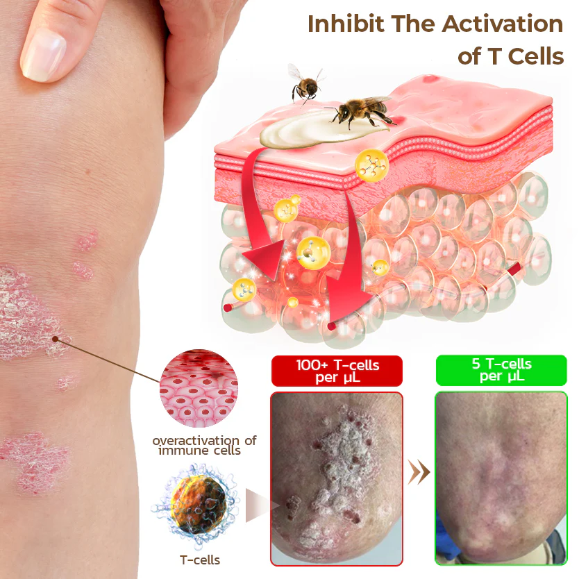 PsoriX Bee Venom Cream - Image 5