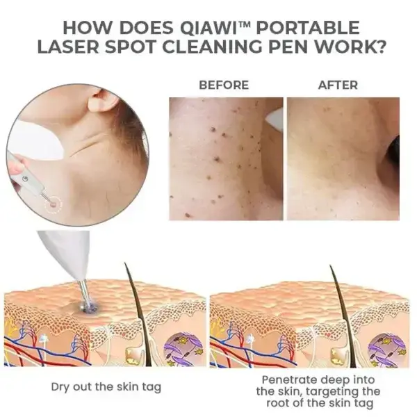 Portable Laser Spot Cleaning Pen - Image 10