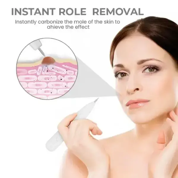 Portable Laser Spot Cleaning Pen - Image 3