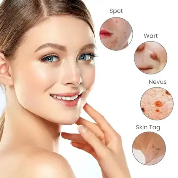 Portable Laser Spot Cleaning Pen - Image 4