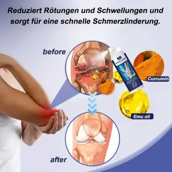 Arnica Emu Joint Relief Complex - Image 3