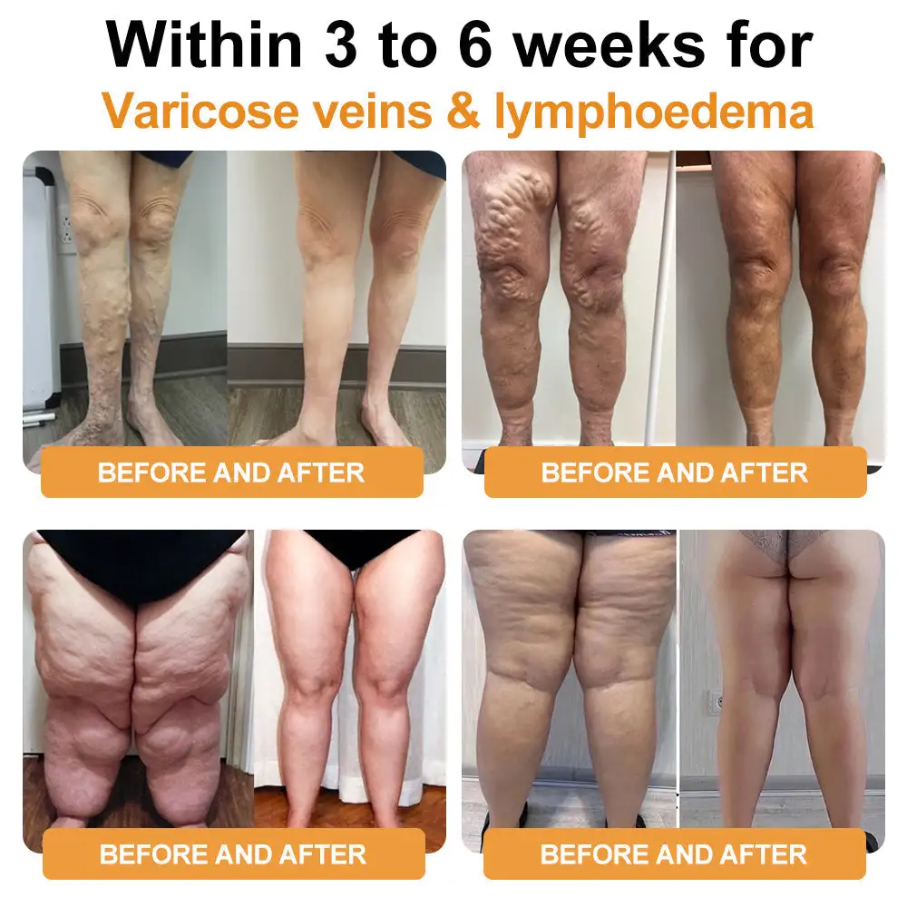 Bee Venom Lymphatic Drainage & Slimming Foot SoakBeads - Image 5